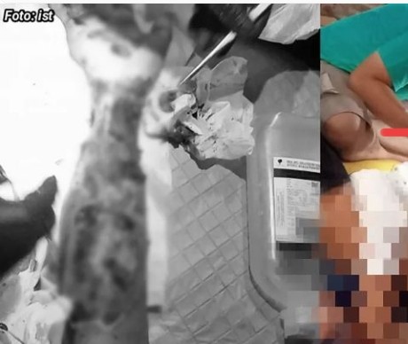 VIRAL! Seorang Santri di Tanggamus lampung tersengat listrik