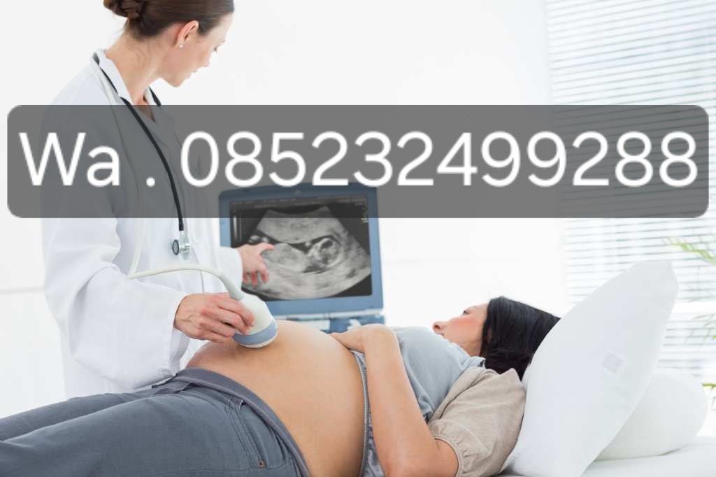 Berapa Lama Proses Aborsi Menggunakan Obat Cytotec Misoprostol 400mcg dan Obat Pembersih Rahim 500mg