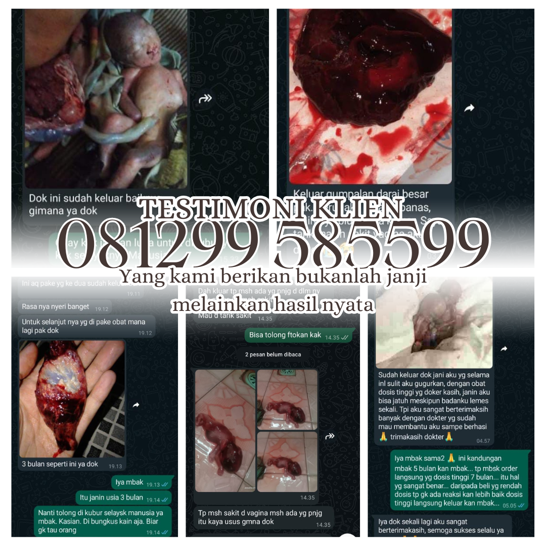 Jual Cytotec 400 Mcg : Obat Penggugur Kandungan 1-8 Bulan Tanpa Kuret